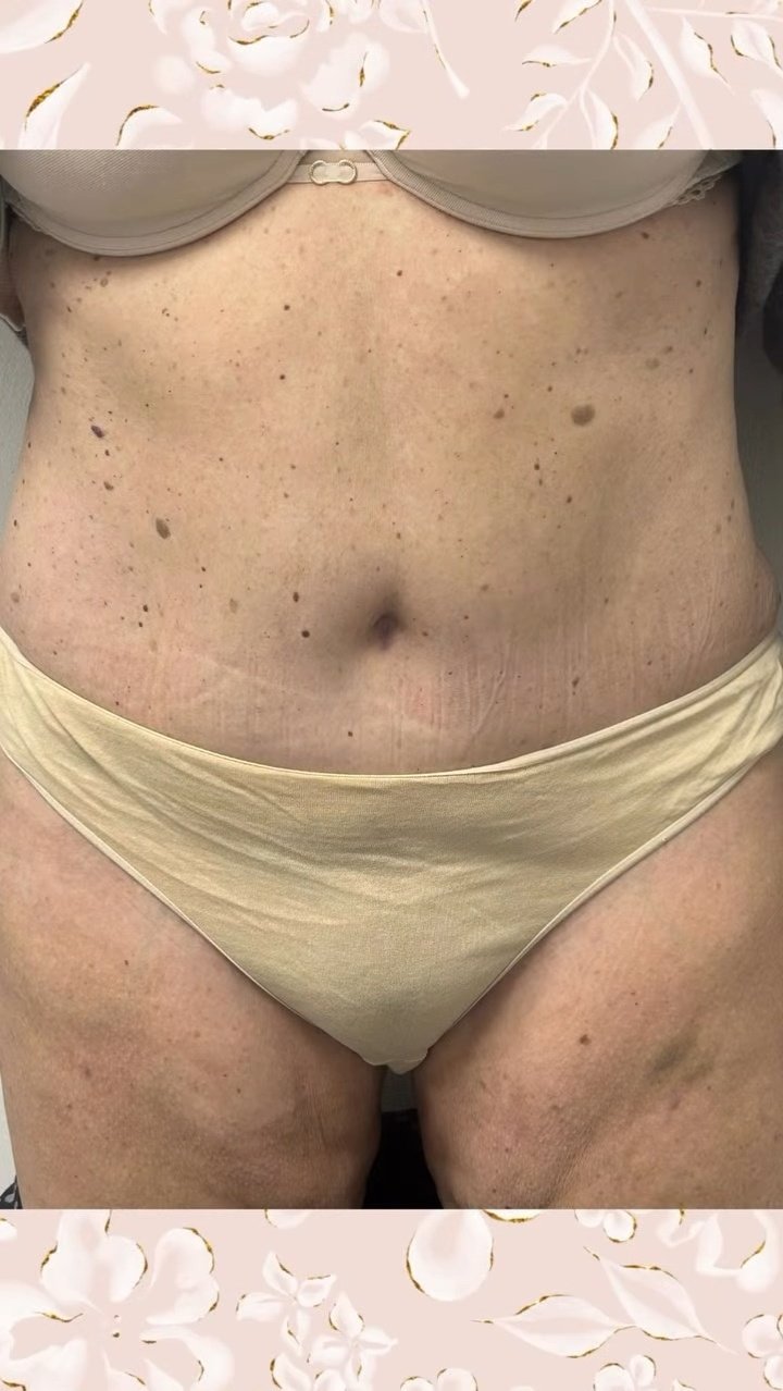 After image