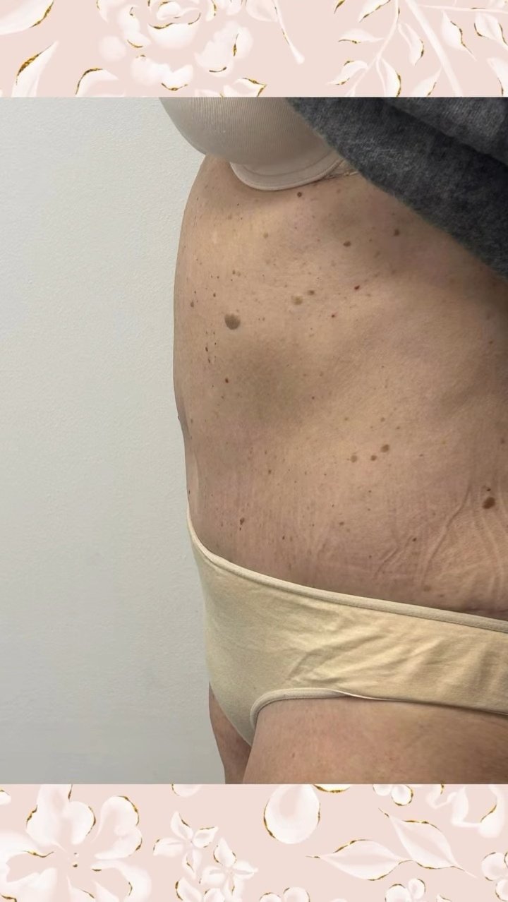 After image