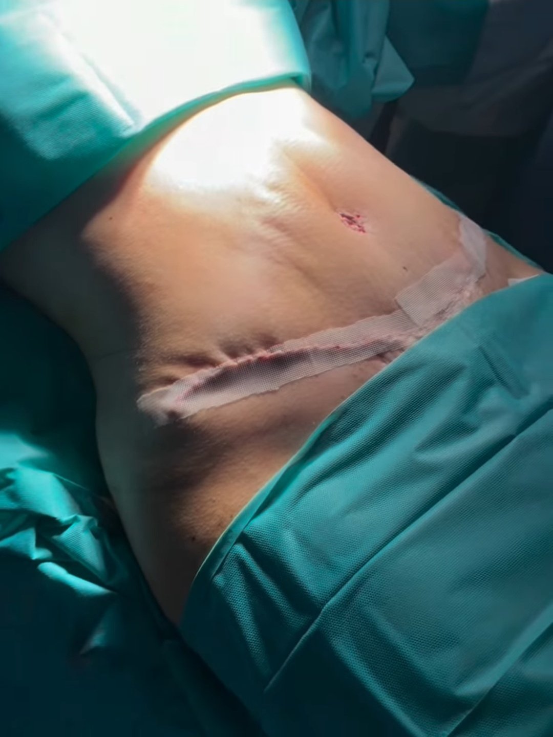 After image