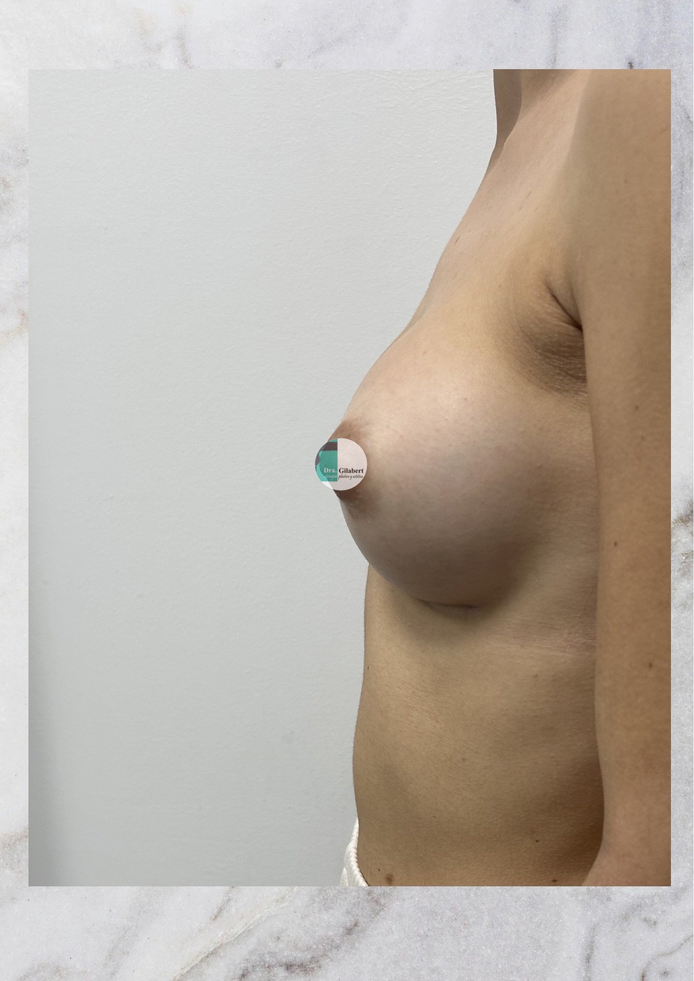After image
