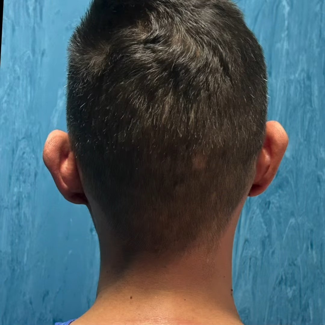 Before image