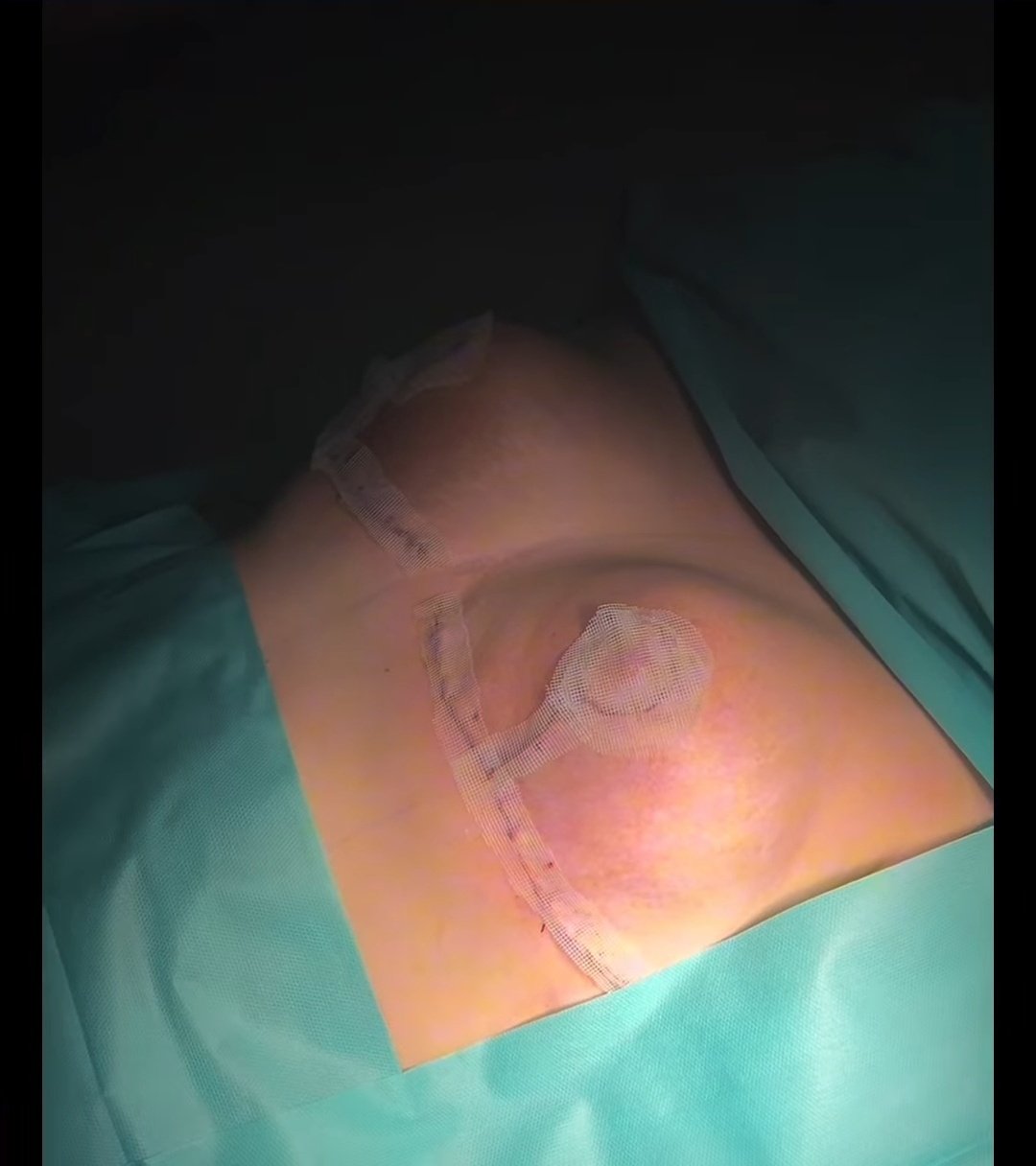 After image