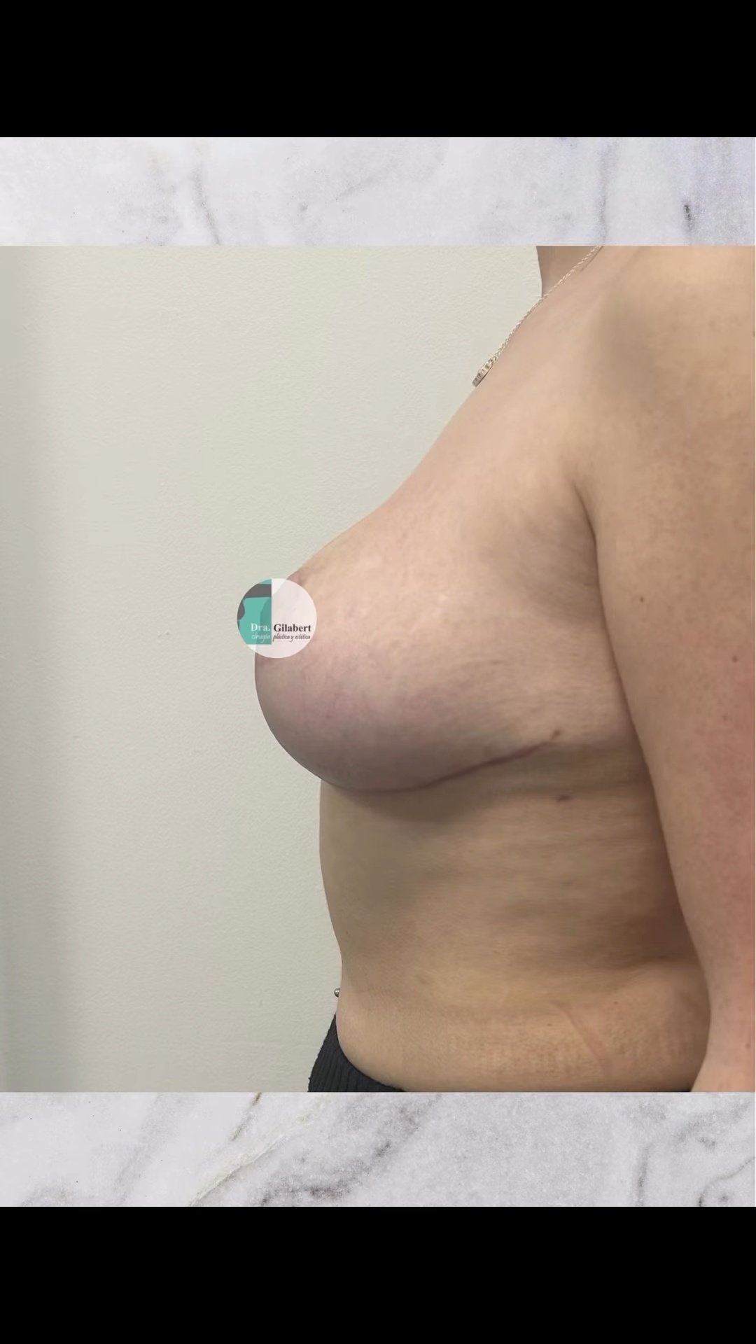 After image